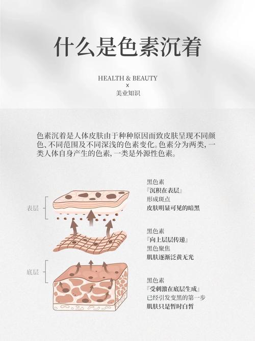 色素沉着是什么颜色