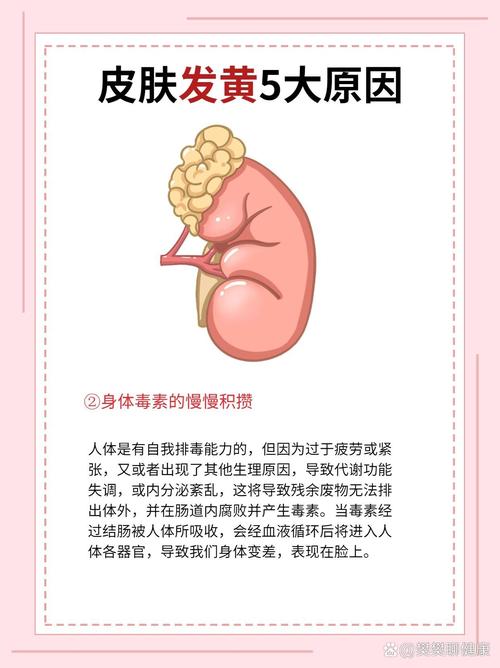 人皮肤黄是什么原因