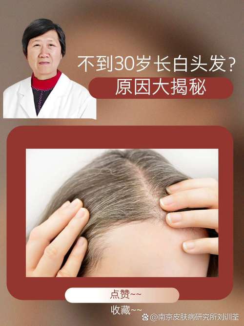 年轻为什么有白头发