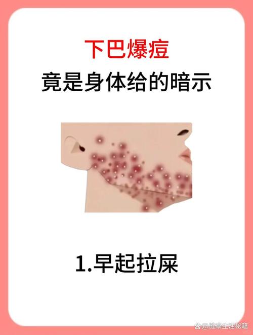 唇周痘是什么原因