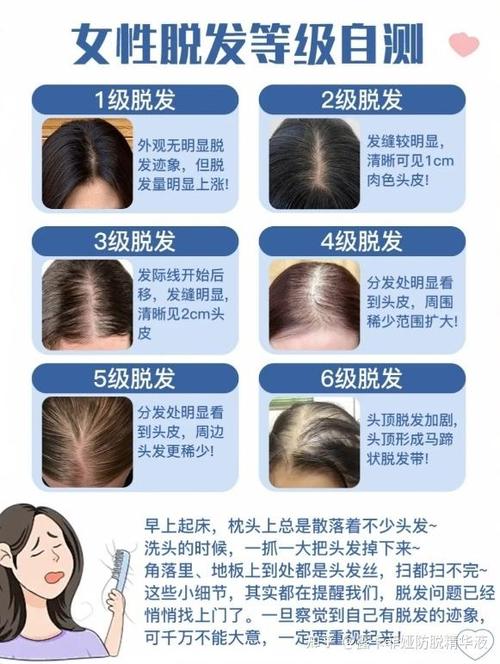 女性掉头发缺什么