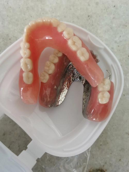 什么是活动假牙