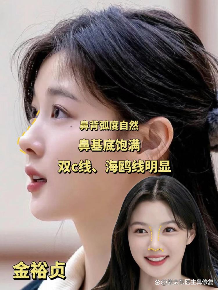 什么是低鼻梁