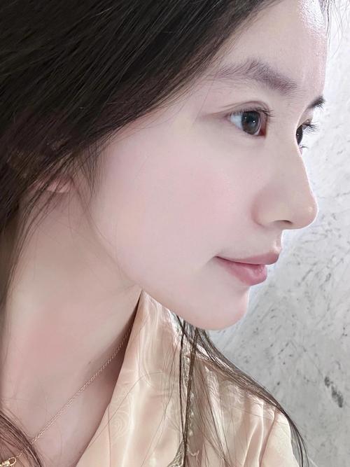 什么是低鼻梁