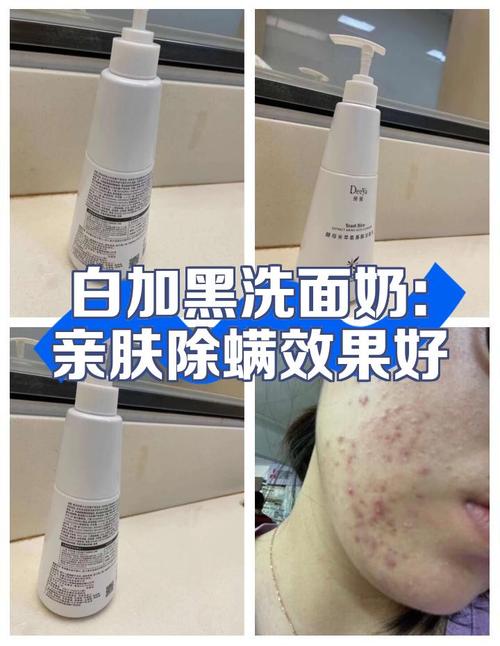 蒲公英美白祛斑霜洗面奶效果怎么样