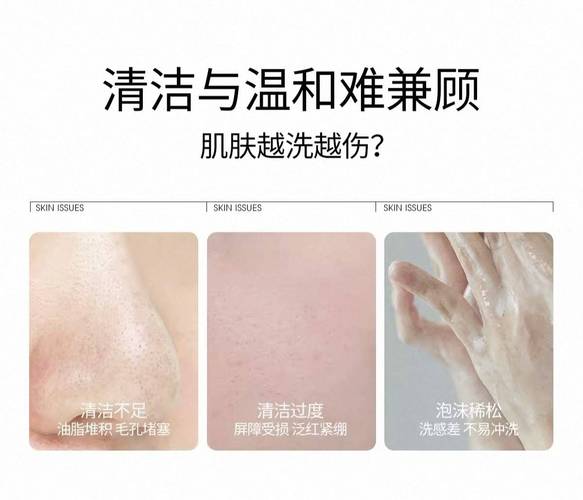 痘痘用什么洗脸