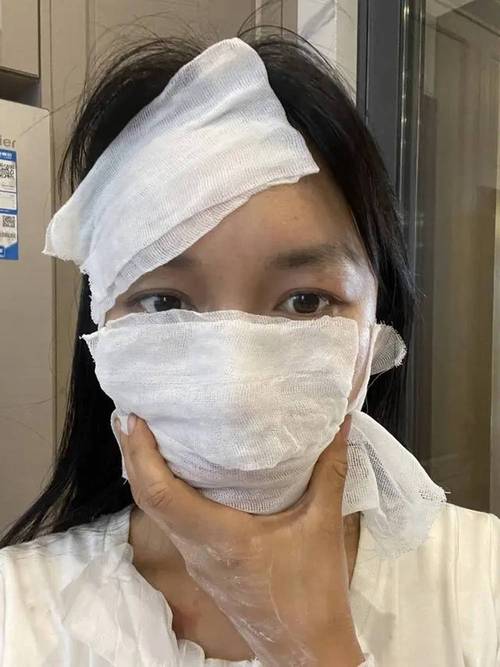 什么会毁容