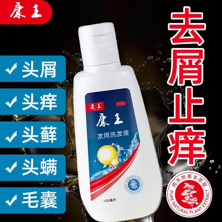 有头皮屑用什么洗发水