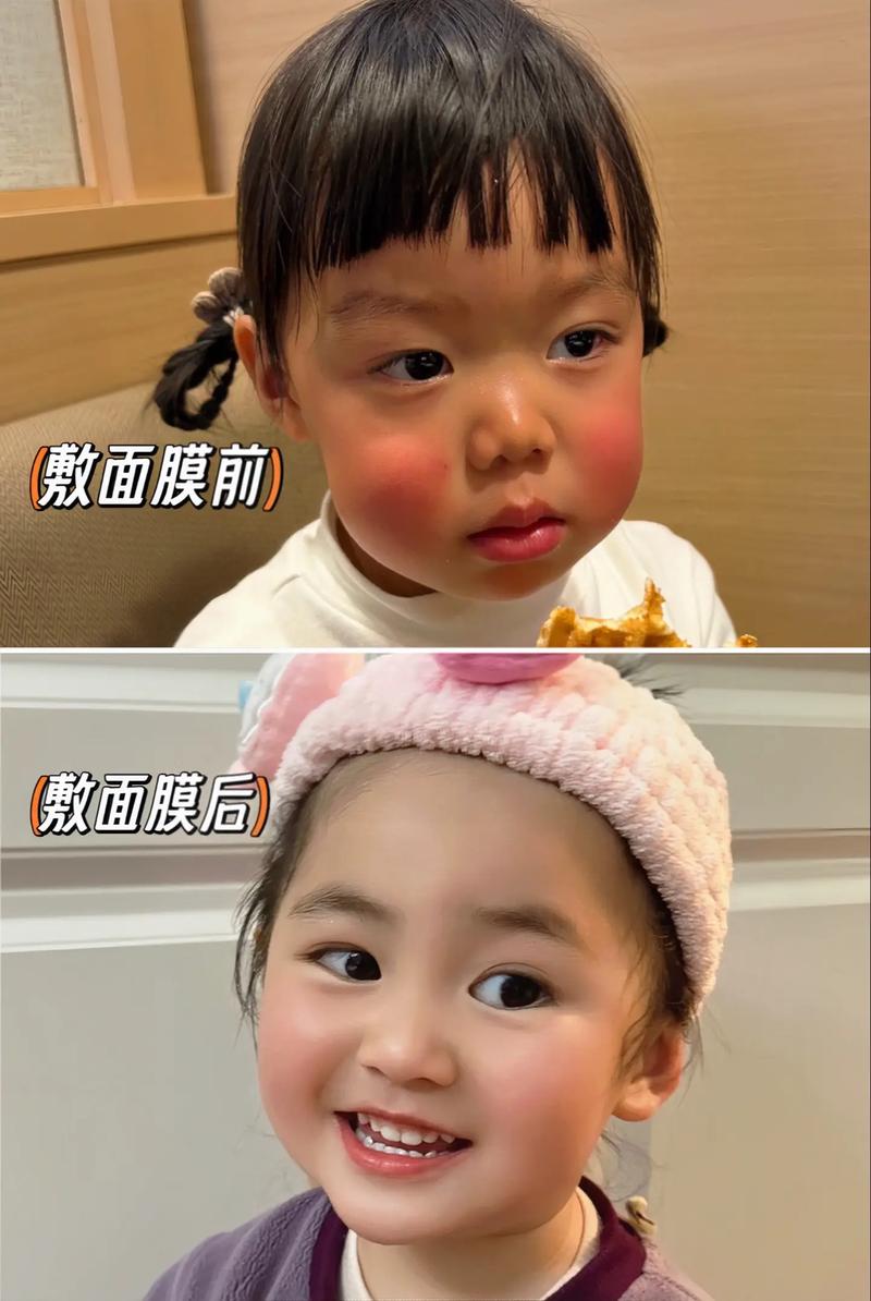 14岁小孩敷面膜会怎么样