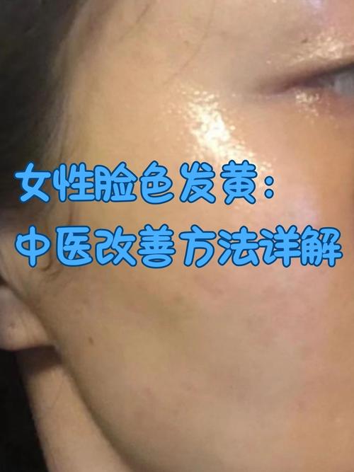 额头发黄是什么原因