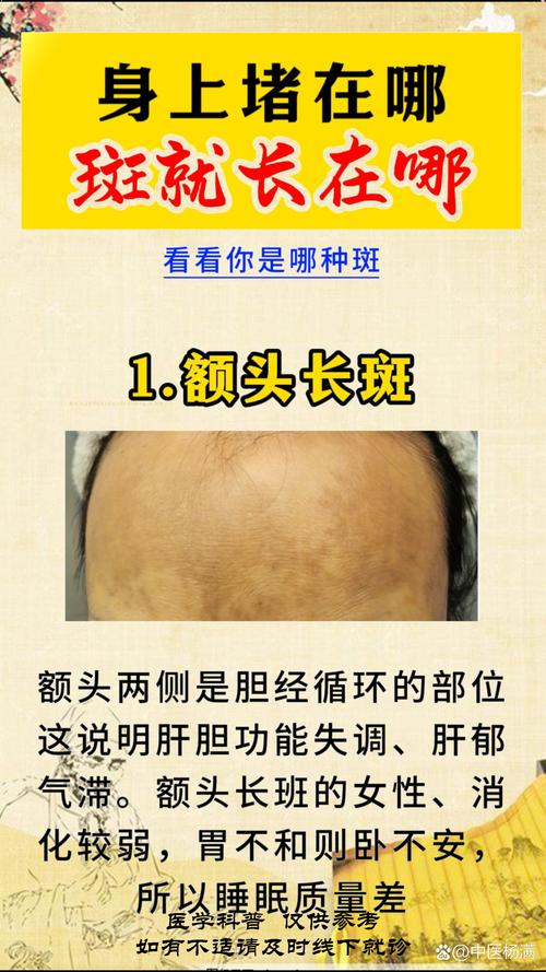 额头发黄是什么原因