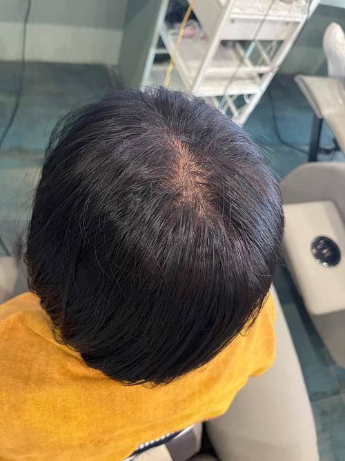 头发不好是什么原因