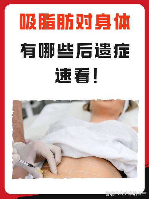 抽脂肪减肥有什么后遗症
