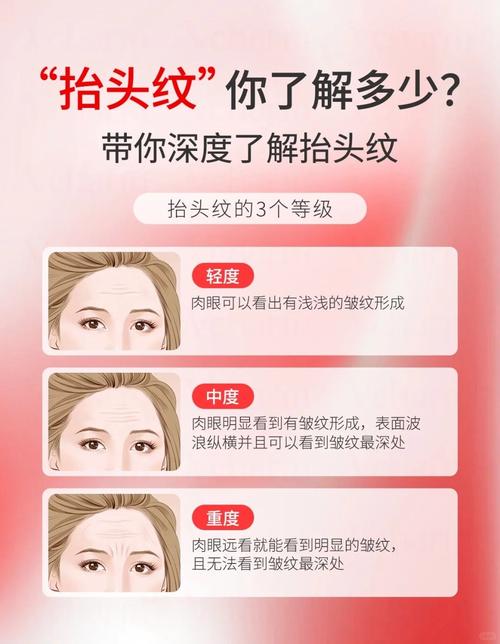 为什么会长抬头纹