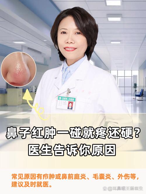 鼻尖红肿是什么原因