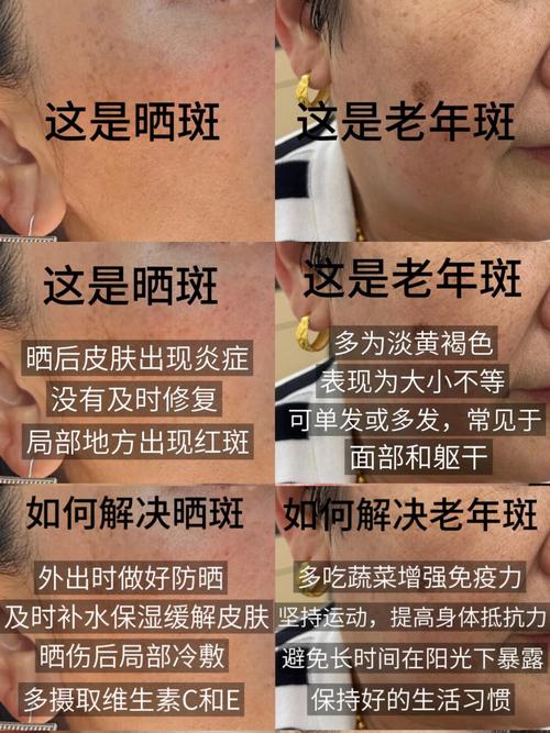 脸上有斑看什么科