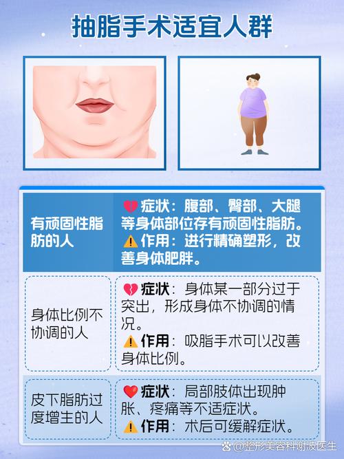 吸脂减肥适合什么人群