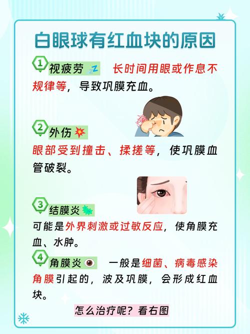白眼球充血什么原因