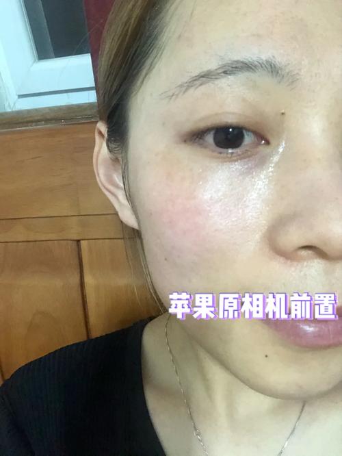 玫瑰花苞水面膜学生用怎么样