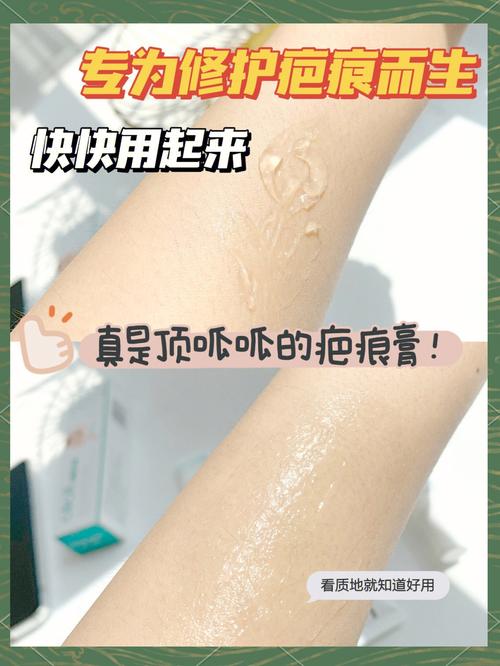 涂什么可以去疤痕