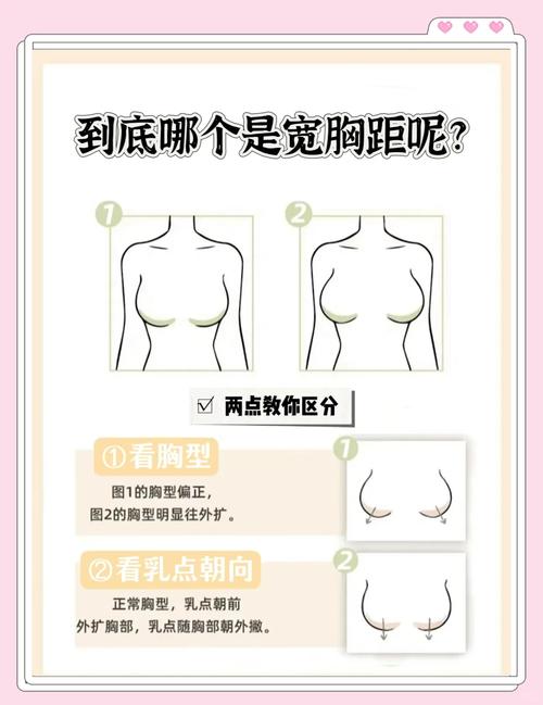 什么是胸部外扩