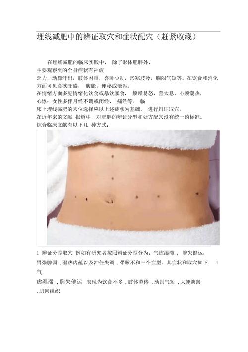 埋线减肥什么症状