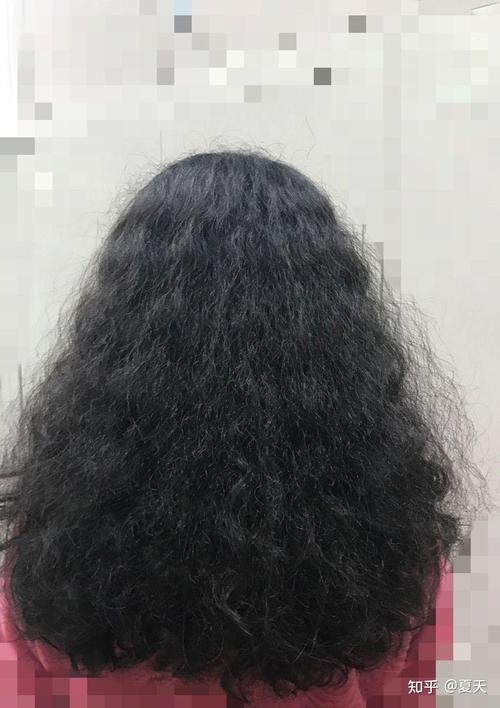 头发为什么会自然卷