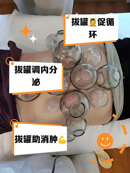 拔罐减肥是什么原理