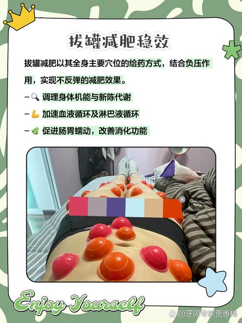 拔罐减肥是什么原理