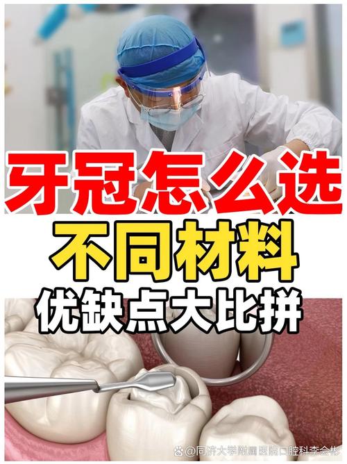 做牙冠什么材料好