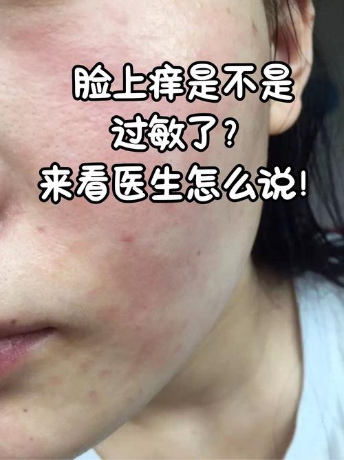 为什么脸上老是过敏