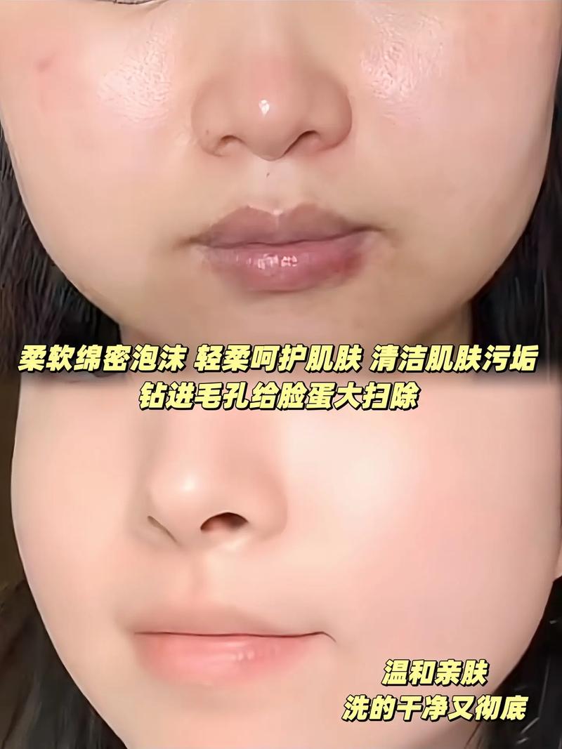 洗面奶洗了脸之后怎么补水