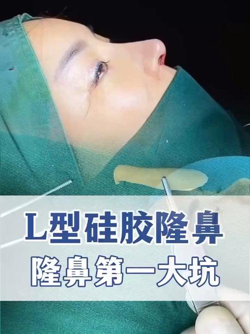 什么是硅胶隆鼻
