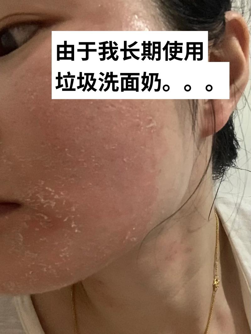 停止用洗面奶后会怎么样