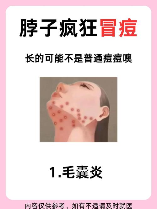 脖子起痘是什么原因