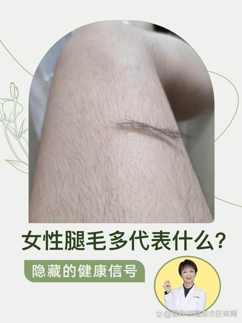 为什么腿毛越来越多