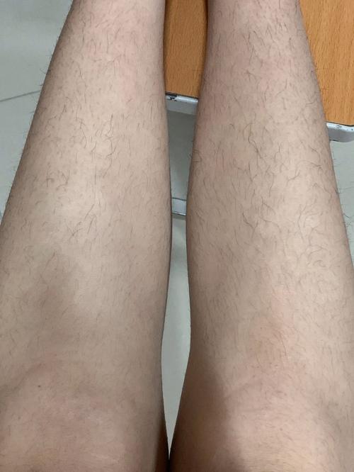 为什么腿毛越来越多