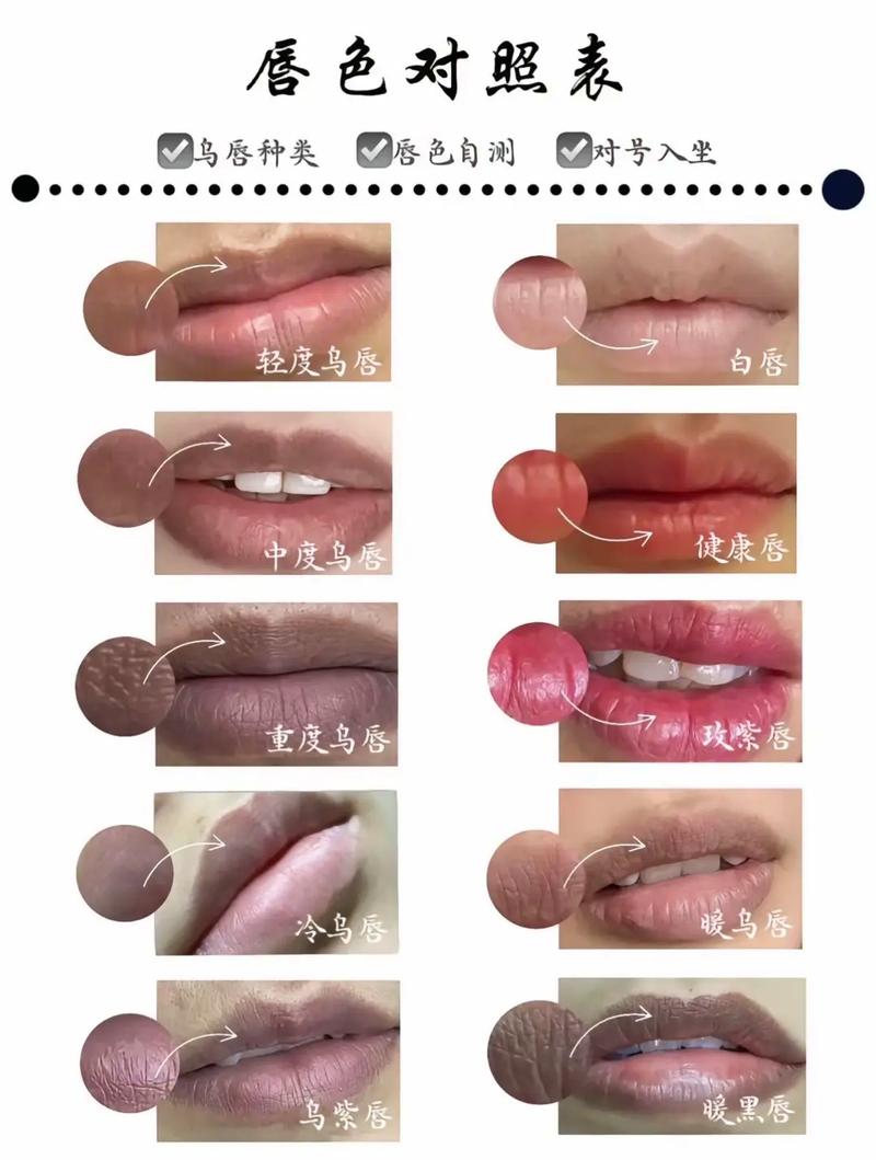唇色暗沉什么原因