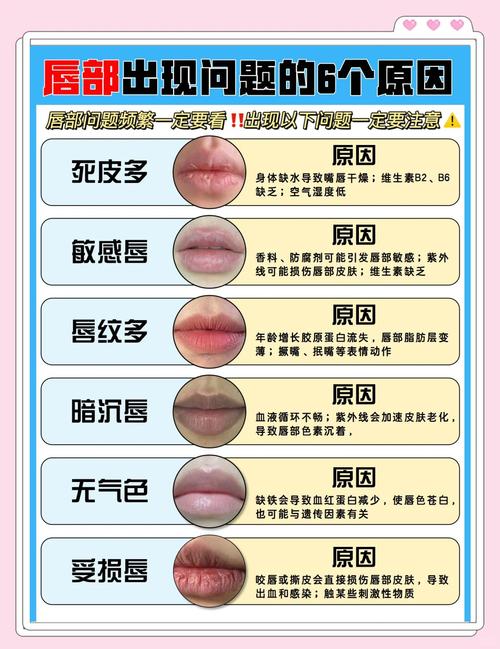 唇色暗沉什么原因