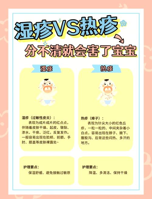 什么原因引起宝宝湿疹