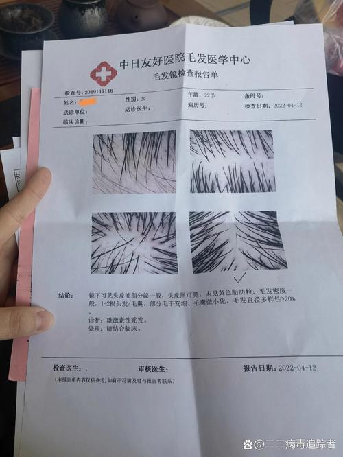 头发脱落挂什么科