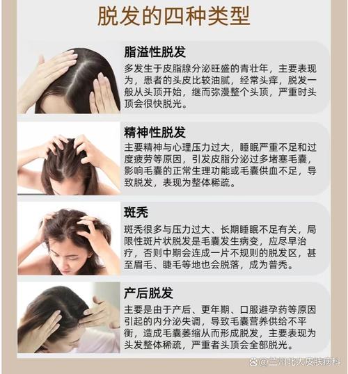 头发脱落挂什么科