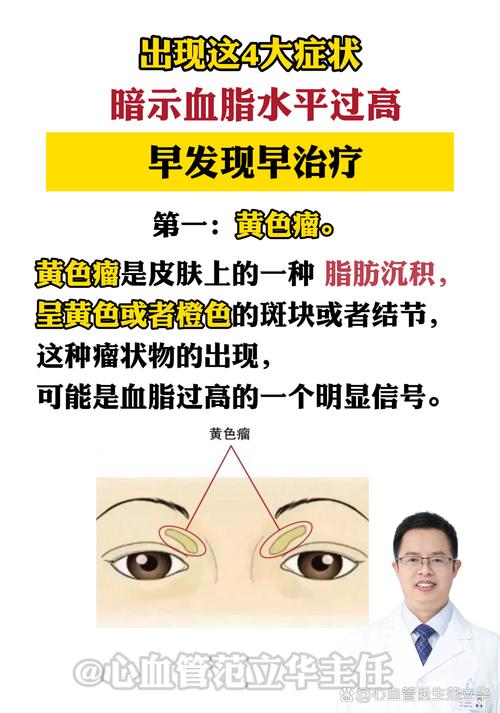 脂肪高有什么症状