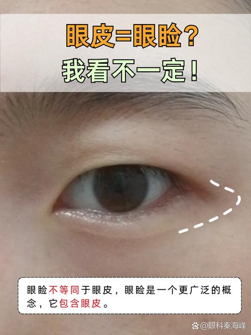 眼睑在什么地方