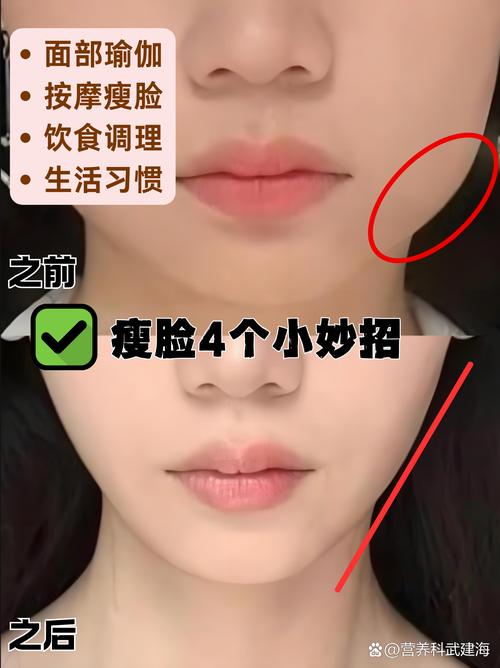 什么办法能瘦脸