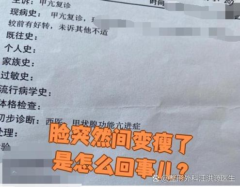 脸瘦什么原因