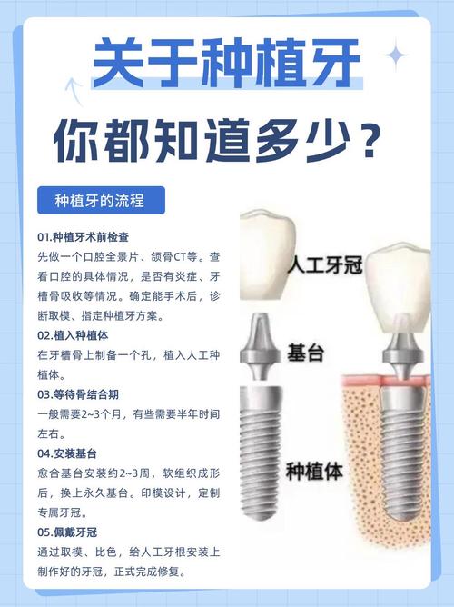 种植牙什么材料最好