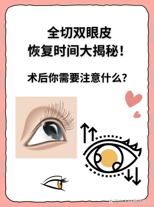 全切是什么