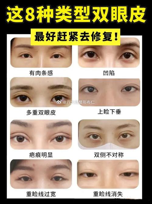 全切是什么