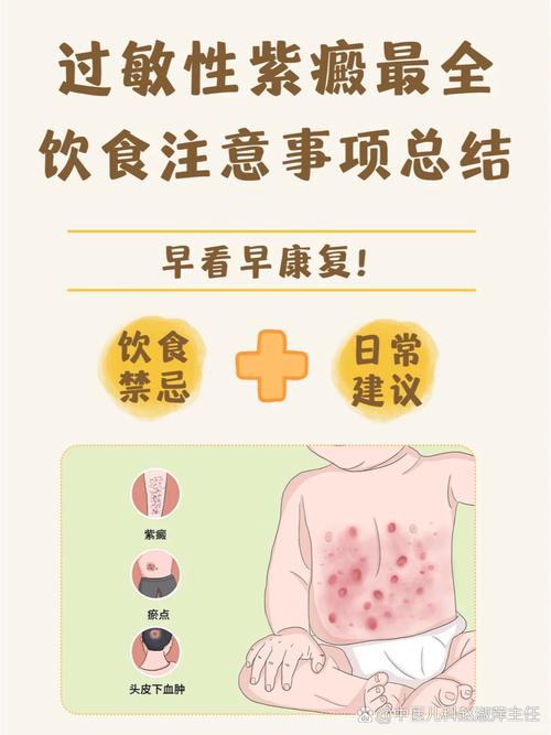 紫癜应该注意什么